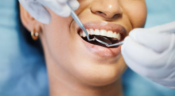 Best Emergency Dental Care for Sports Injuries in Cudahy, WI